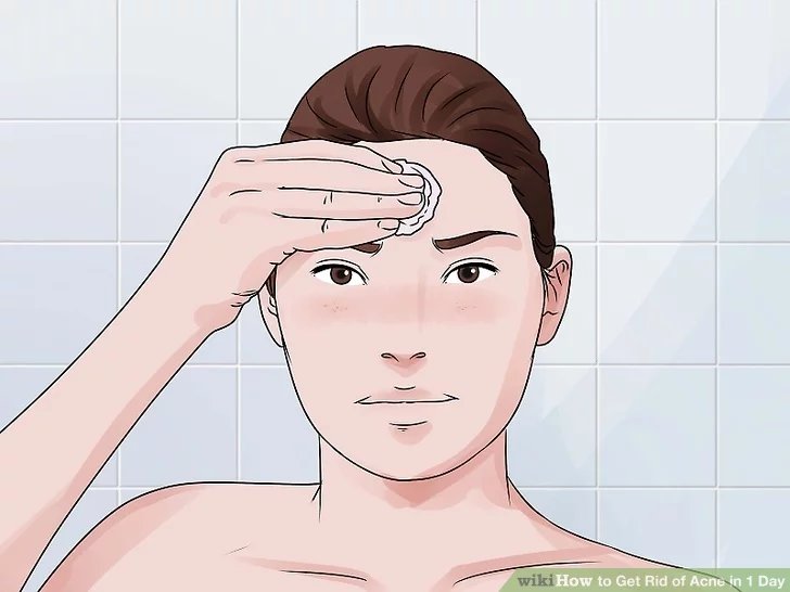 How to remove acne effectively in just 1 day Picture 4