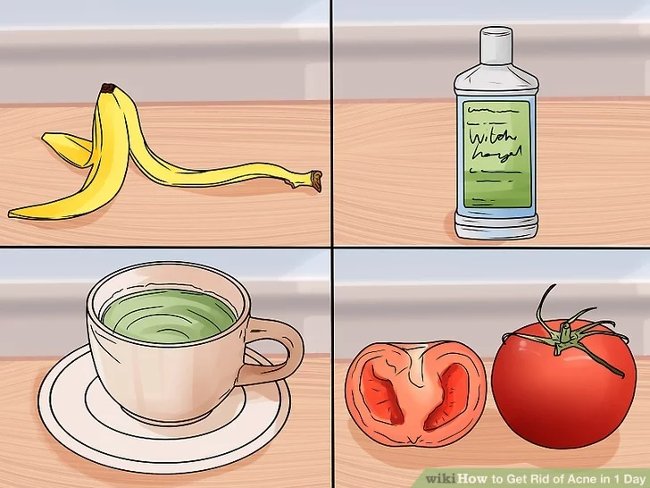 How to remove acne effectively in just 1 day Picture 7
