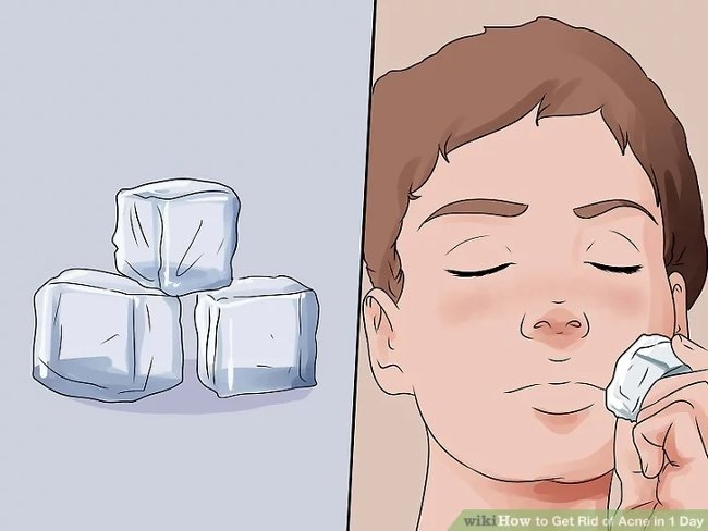 How to remove acne effectively in just 1 day Picture 8