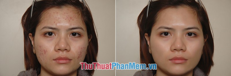 How to smooth skin with Photoshop Picture 9