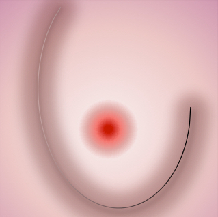 How to Start Making a Breast Icon Picture 6