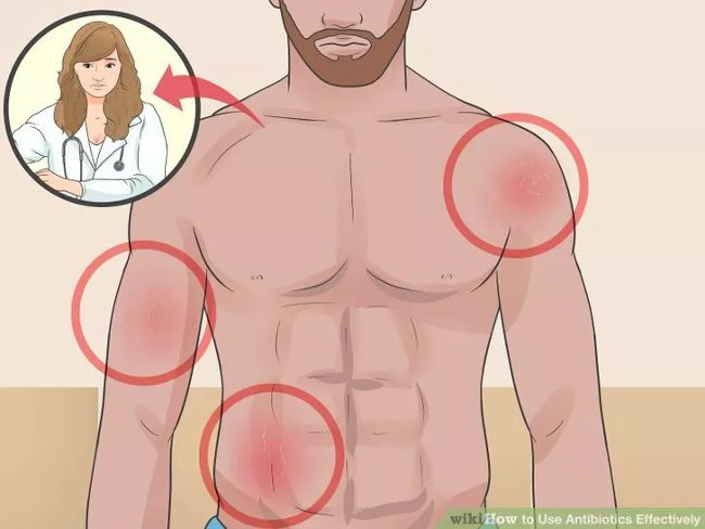 How to use antibiotics effectively? Picture 12