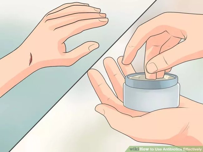 How to use antibiotics effectively? Picture 16