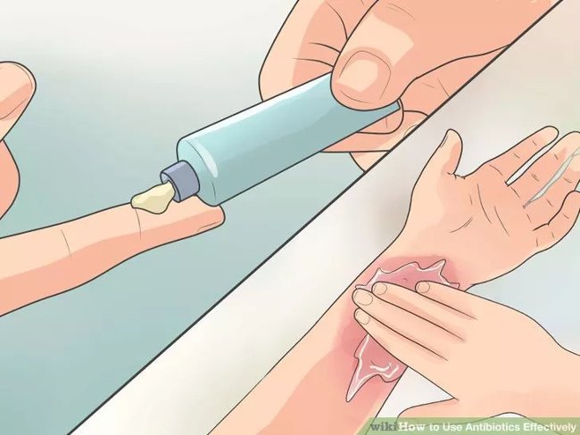 How to use antibiotics effectively? Picture 17