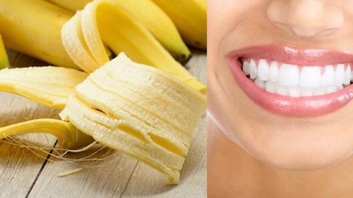 How to whiten yellow teeth at home quickly and effectively Picture 5