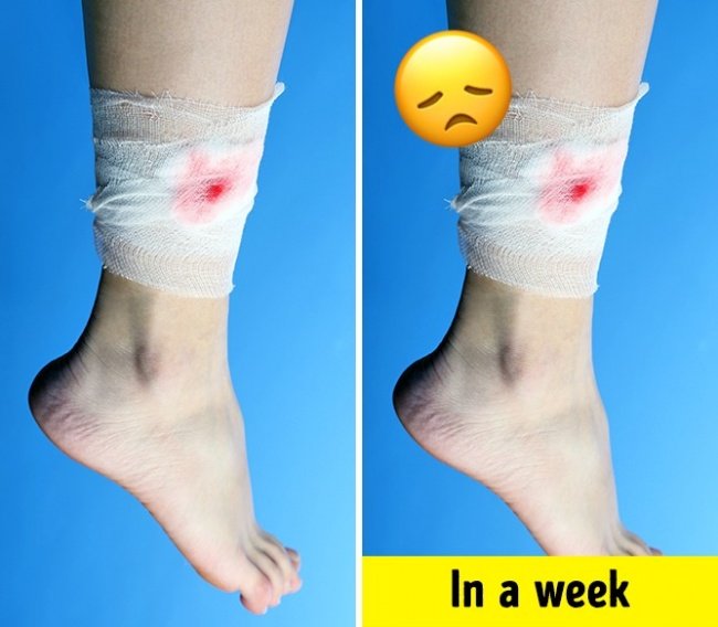 If your body has these 12 signs, you are eating too much sugar! Picture 10