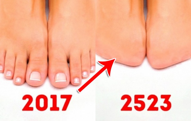 In the future, these excess body parts may completely disappear due to evolution Picture 5