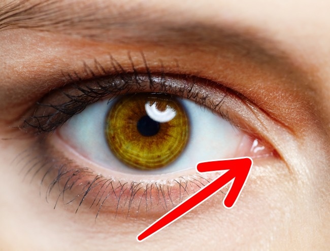 In the future, these excess body parts may completely disappear due to evolution Picture 7