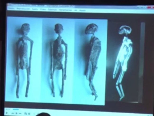 Is the 'alien skeleton' found in Peru true? Picture 1