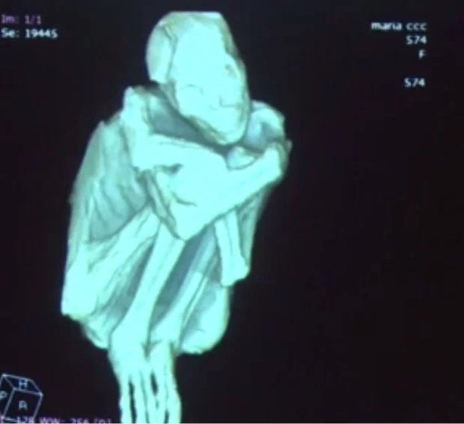 Is the 'alien skeleton' found in Peru true? Picture 3