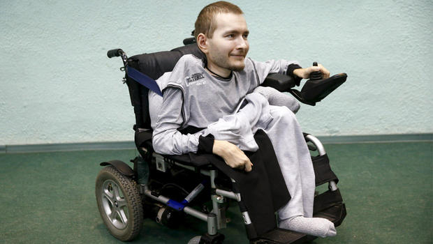 Italian doctor declares successful implementation of a human head transplant on the body Picture 2