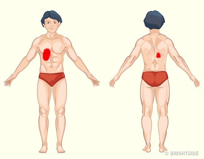 Look at the pain location to identify the dangerous disease Picture 8