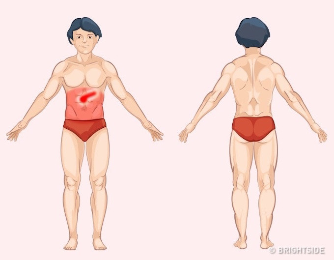 Look at the pain location to identify the dangerous disease Picture 9
