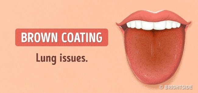 Look at the tongue guess: 13 signs not to be missed Picture 11