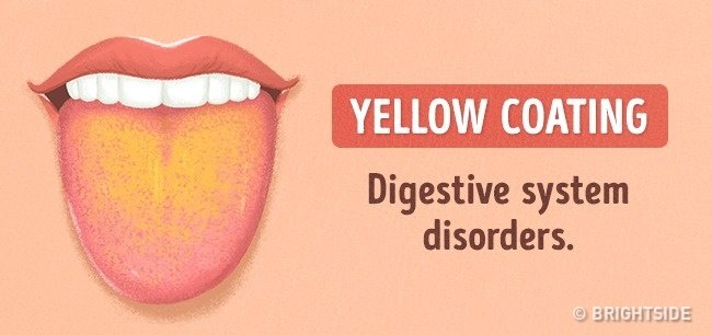 Look at the tongue guess: 13 signs not to be missed Picture 12