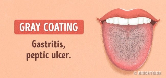 Look at the tongue guess: 13 signs not to be missed Picture 13