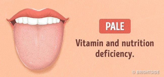 Look at the tongue guess: 13 signs not to be missed Picture 7