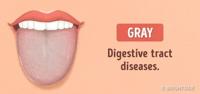 Look at the tongue guess: 13 signs not to be missed Picture 9