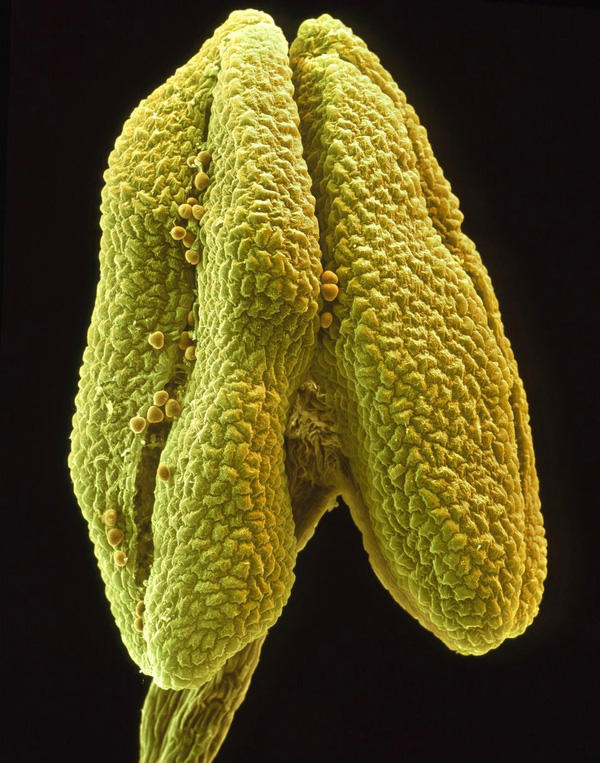 Marvel at the bizarre images of flowers when observing under a microscope Picture 6