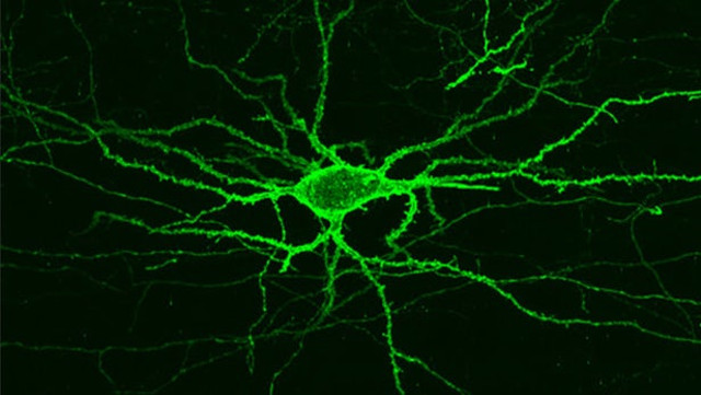 MIT's imaging techniques shed light on brain activity Picture 1