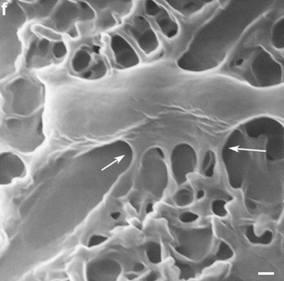 New discovery: Dragonfly wings can kill bacteria without antibiotics Picture 3