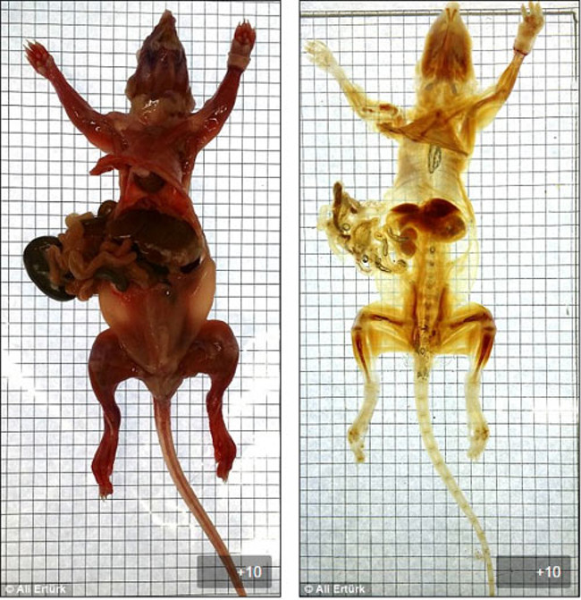 New techniques to diagnose diseases without X-rays Picture 1