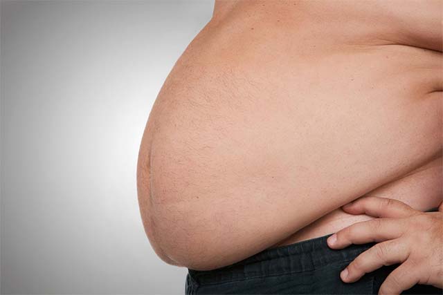 Not dieting, this is the new method of preventing obesity Picture 1
