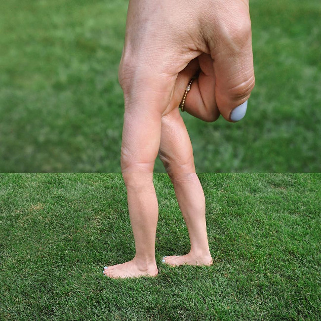 Painful stomach pain with 18 unrelated fantasy images that are unbelievably related Picture 17