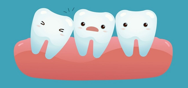 Recognize the symptoms of wisdom teeth for better coping Picture 2