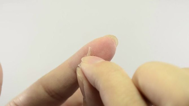 Removing 502 glue on the skin is extremely simple Picture 10