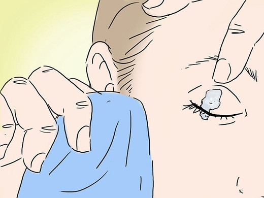 Removing 502 glue on the skin is extremely simple Picture 7