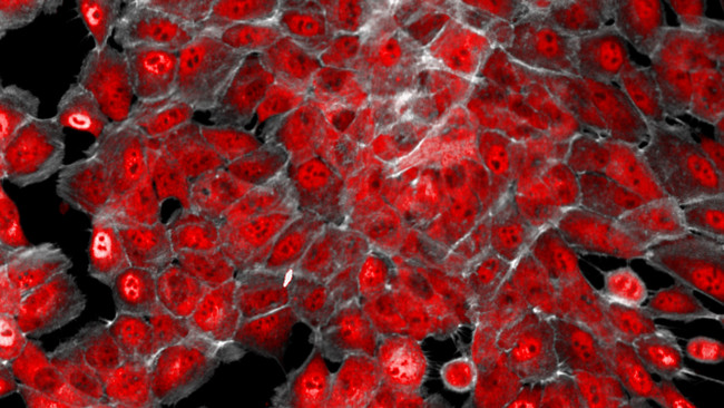 Researchers found new antibodies to kill cancer cells Picture 1