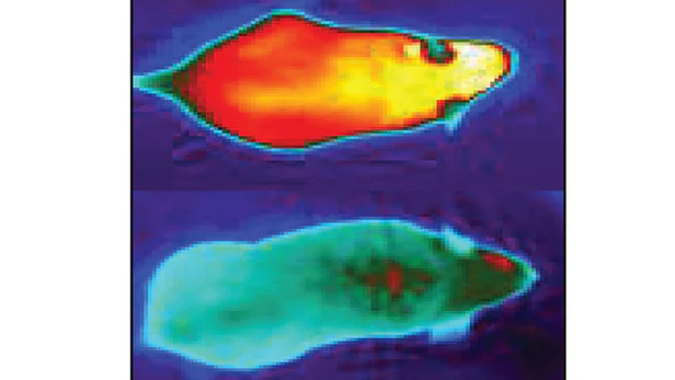 Scientists identify genes capable of burning brown fat Picture 1