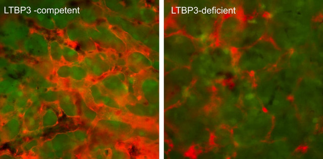 Scientists who find proteins can prevent metastatic cancer Picture 1