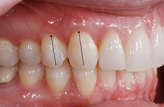 Signs of heart disease should not be ignored Picture 6