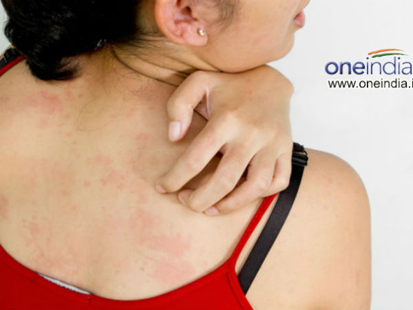 Signs of your body are missing a serious vitamin Picture 4