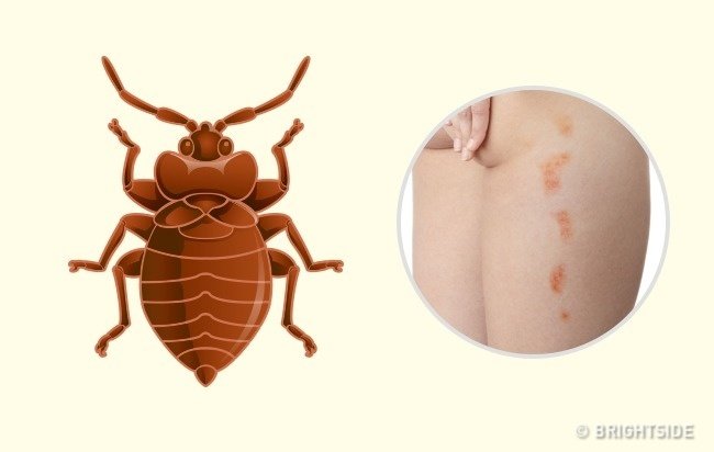 Simple way to 'identify' insect bites Picture 10