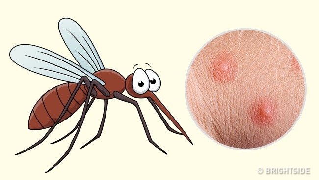 Simple way to 'identify' insect bites Picture 4