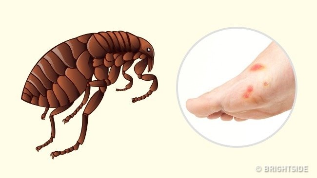 Simple way to 'identify' insect bites Picture 6