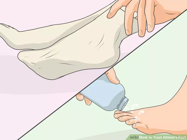Solution for treating athlete's foot Picture 12