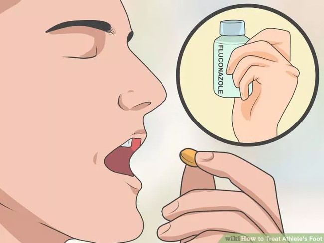 Solution for treating athlete's foot Picture 14