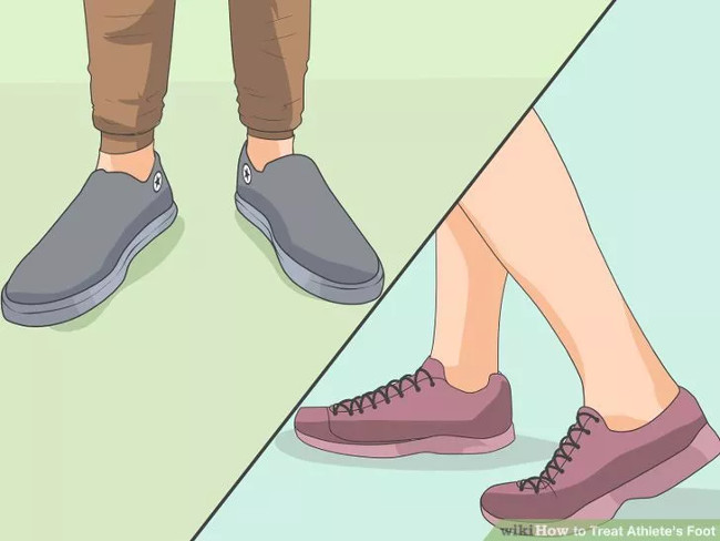 Solution for treating athlete's foot Picture 16