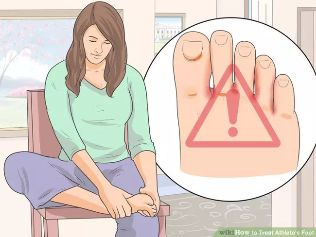 Solution for treating athlete's foot Picture 3