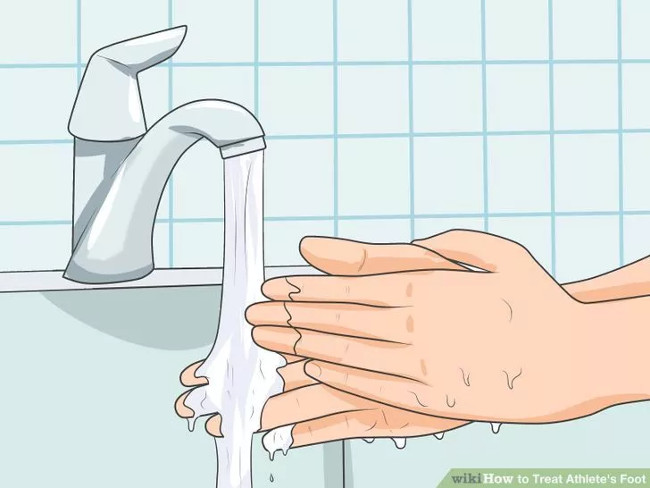 Solution for treating athlete's foot Picture 7