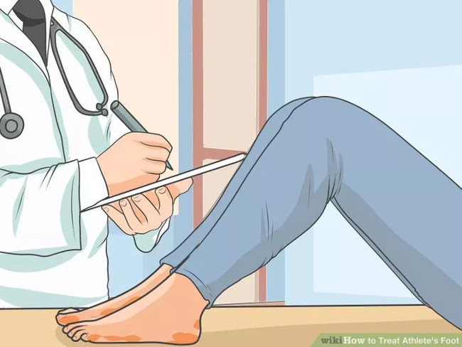 Solution for treating athlete's foot Picture 8