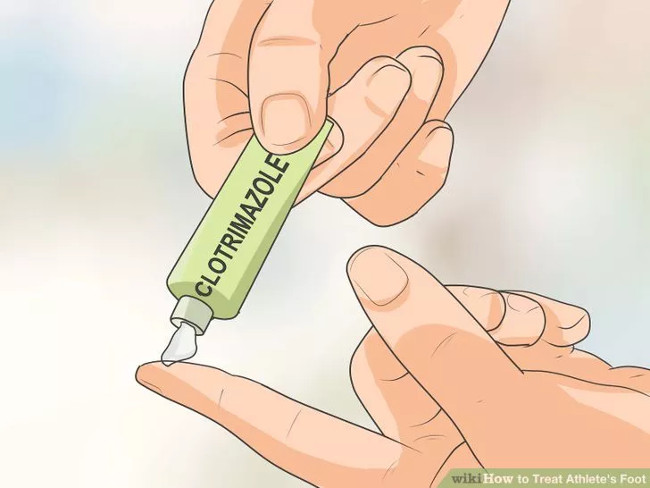 Solution for treating athlete's foot Picture 9