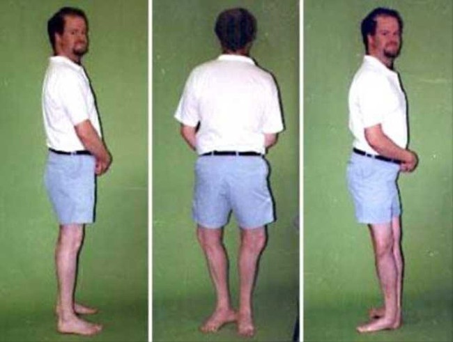 Strange story: The man can turn 180 degrees upside down Picture 1