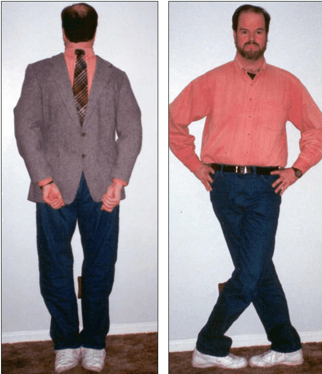 Strange story: The man can turn 180 degrees upside down Picture 2