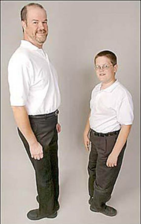 Strange story: The man can turn 180 degrees upside down Picture 3