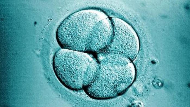 Strangely, people with 45% burns are healed quickly with stem cell therapy Picture 4